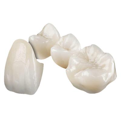 Zirconia Dental Crown: Perfectly Fit, Natural Appearance