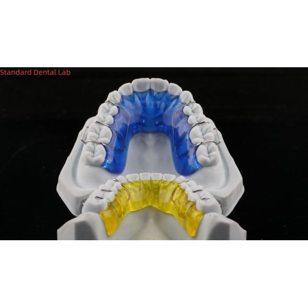 Comfortable Stainless Steel Acrylic Hawley Retainer Effective Orthodontics Appliance