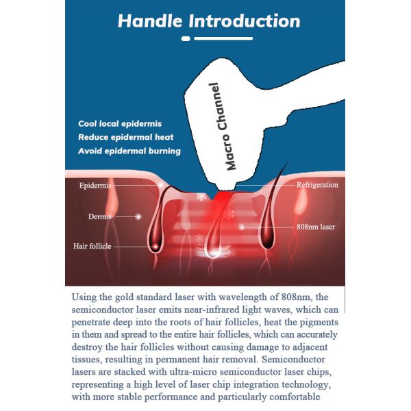 vertical professional diode laser 808nm hair removal machine / Newest Best price 808nm diode laser hair removal machine