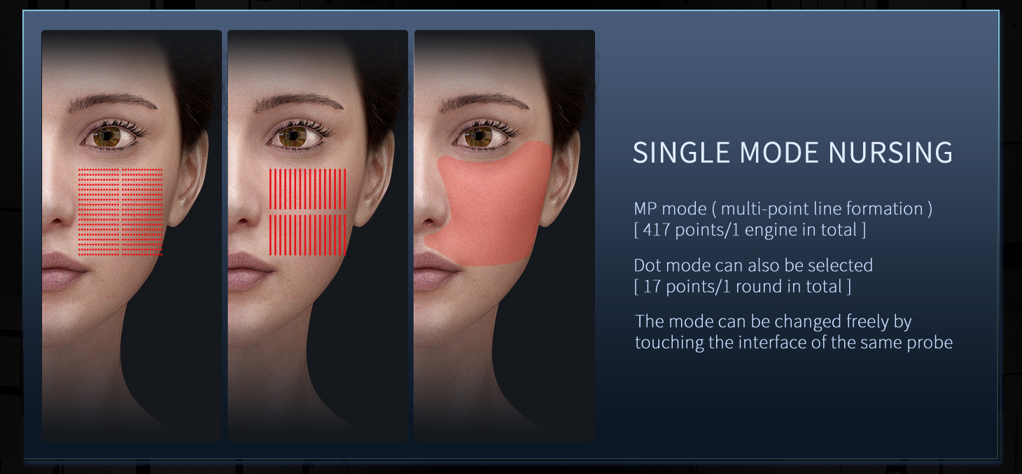 2 Handle Portable 11d Weight Loss Skin Tightenin Hifu Body Slimming Beauty Machine