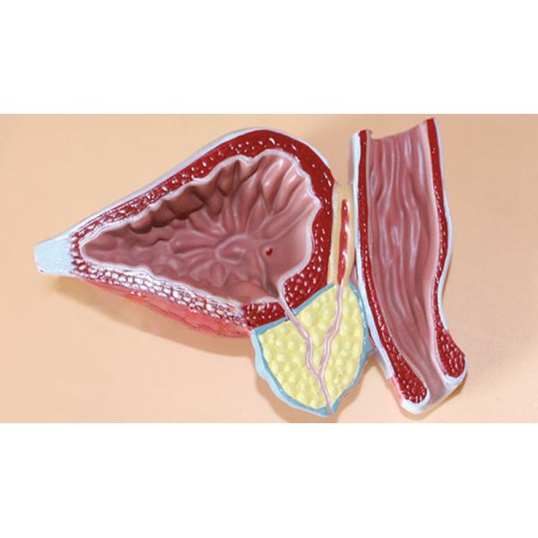 Human Anatomy PVC Simulation Human Pathology Prostate Model For Medical Educational