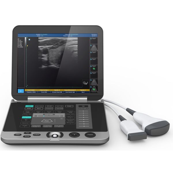 High Resolution Laptop B/W Ultrasound MSK Ultrasound Scanner Laptop Ultrasound Machine