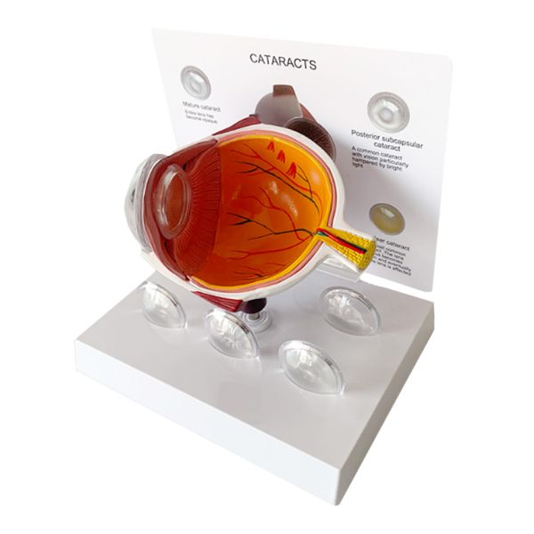 Human Eyeball Cataract Anatomy Medical Science Human Eye Anatomy Model