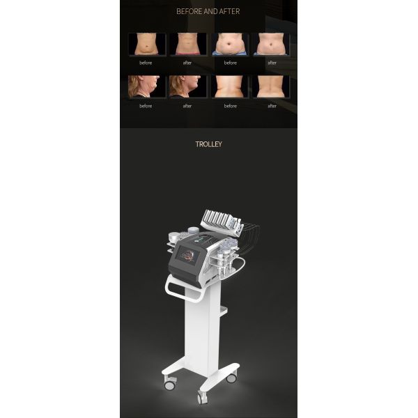 Машина 6 кавитации вакуума RF в 1 коже 40K затягивая формирующ оборудование красоты