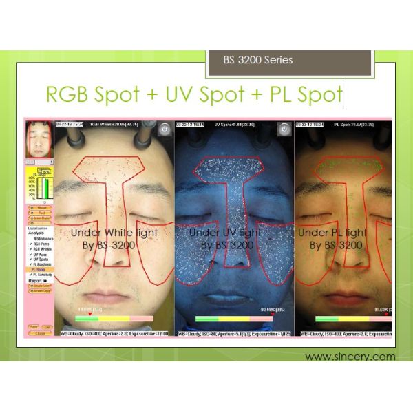 Skin Analyzer Facial Skin Analyzer BS-3200