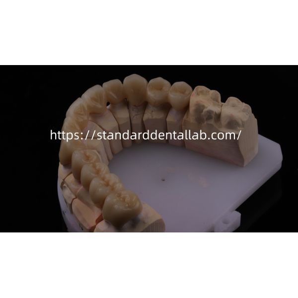 Высокопрочный и естественный по внешнему виду слоистый фарфор для слоистой стоматологии Циркония корона Китай стоматологическая лаборатория