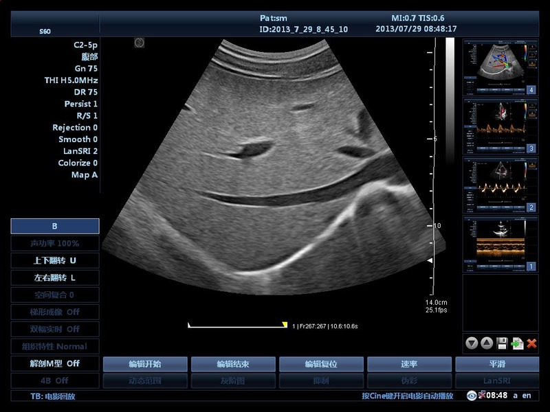 Hospital Outside Trolley 15Inch Ultrasound Machine Ultrasound Digital Color Doppler Ultrasound Machines edical