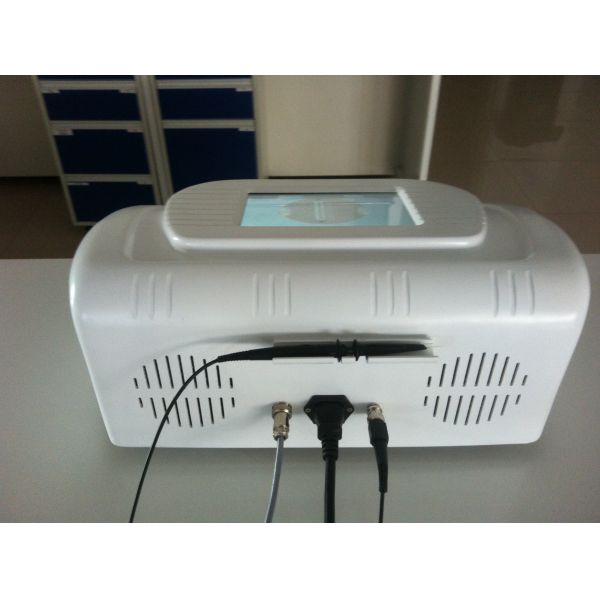 medical devices distributor 30MHz RBS Spider Vein Removal(Face, Arm, Leg) Machine NBW-V700