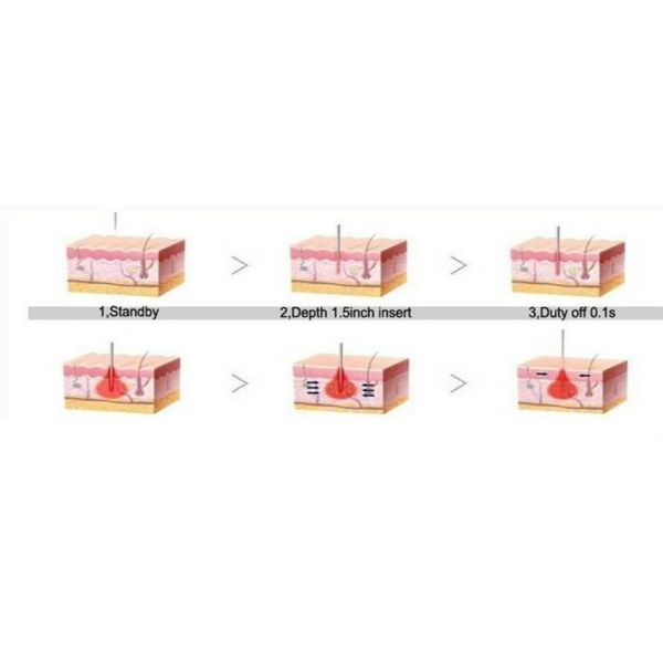 2018 high performance fractional rf/wrinkles removal/beauty equipment