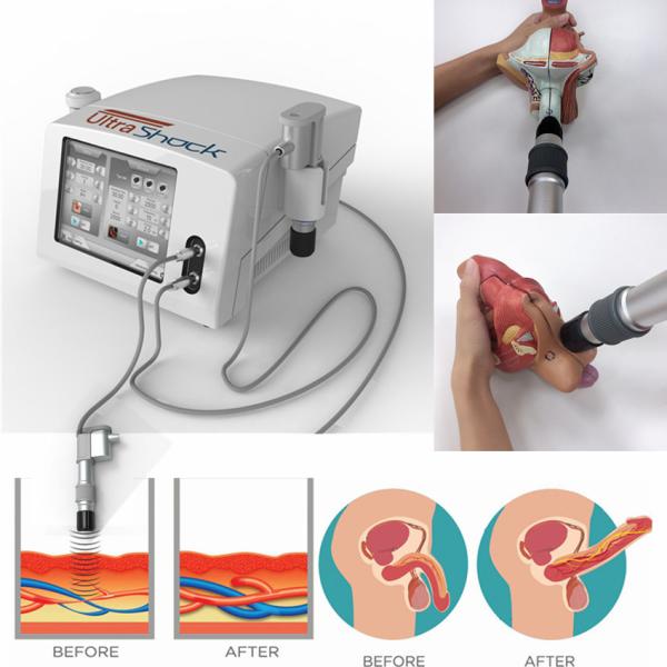 Máquina física radial da terapia da inquietação do ultrassom de 6 barras
