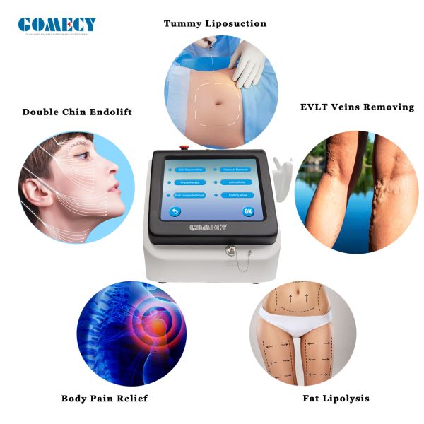 Машина для лазерной терапии потери жира 980 нм Усовершенствованное оборудование для лазерной липосакции