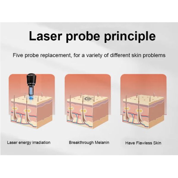 Q Switched ND Yag Laser Machine 1064nm 532nm для удаления морщин в глазах