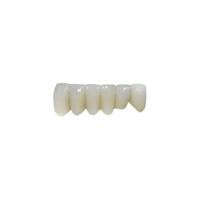 OEM Implante de zircônio ponte fixa de coroa dentária
