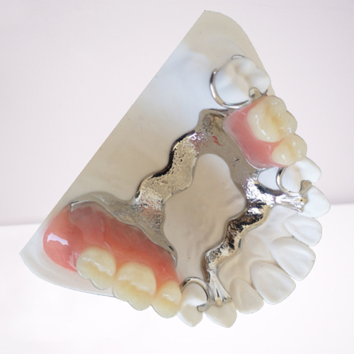 Customized PFM Tooth Crown 3D Printing PFM Dental Bridge
