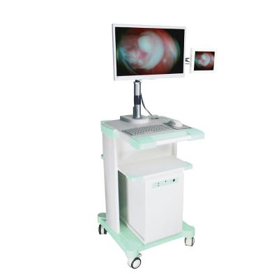 Agulha de aço inoxidável Trocar Laparoscopic descartável com a câmera ótica de Trocar
