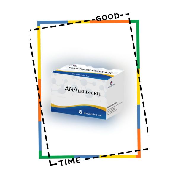 Anti ANA IgG ELISA Test Kit Anti Nuclear IgG Antibody Qualitative Detection