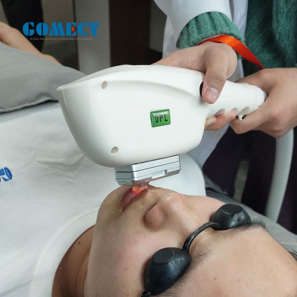 Professional IPL SHR Elight Machine for Dark Skin 3000W IPL Drive Power 7mm Spot Size