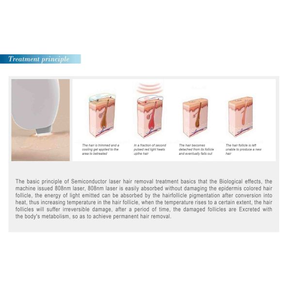 808 diode laser hair removal machine FDA approved laser hair removal machine