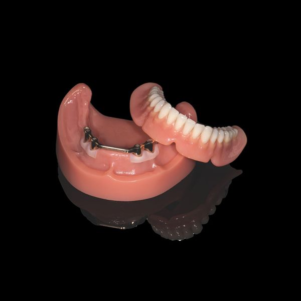 Pink Titanium Bar Removable Dentures With Acrylic Denture Finish