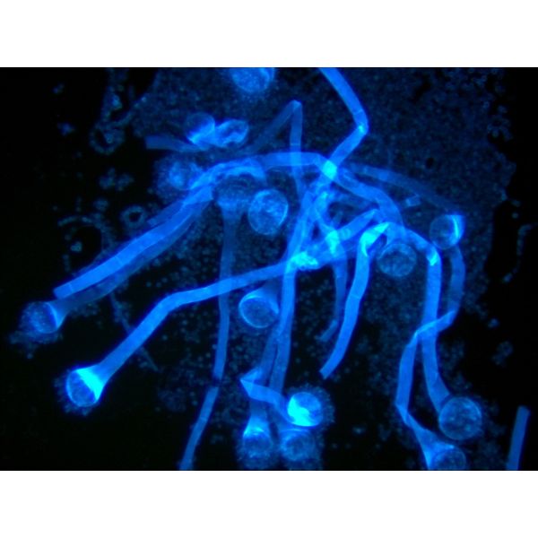 Fluorescence attachment for immunofluorescence microscope