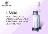Frequência fracionária 10mj do poder 33.3Hz da máquina 50W do laser do CO2 da remoção da acne - energia 130mj