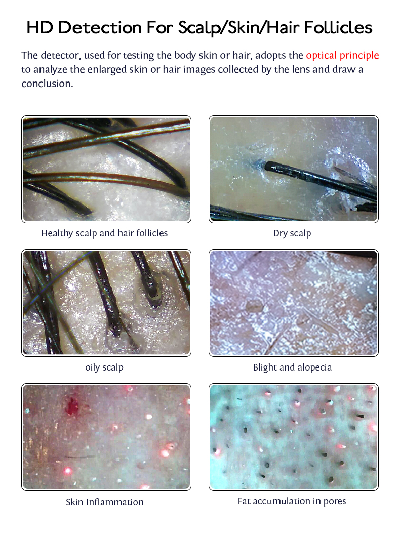 3 кг / 36 * 29 * 21 см Размер Сканер волосяных фолликулов для салона и спа-салона