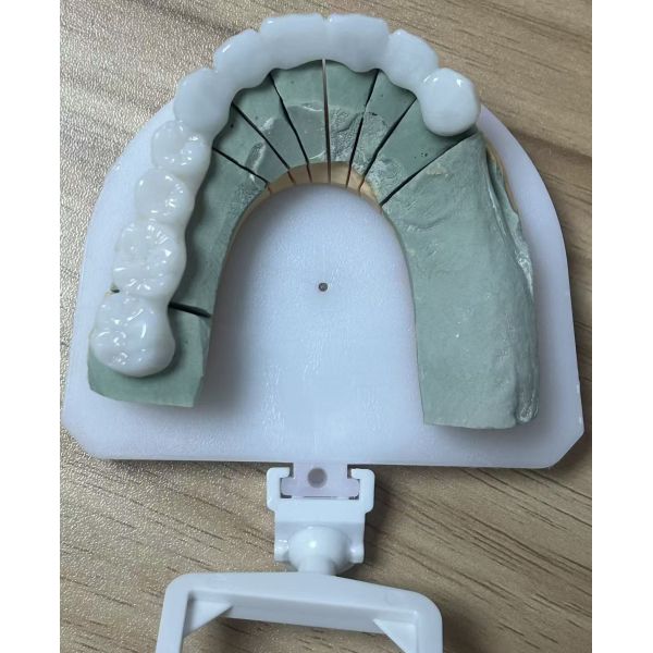 Full Zirconia dental bridge for high strength and durable dental restoration