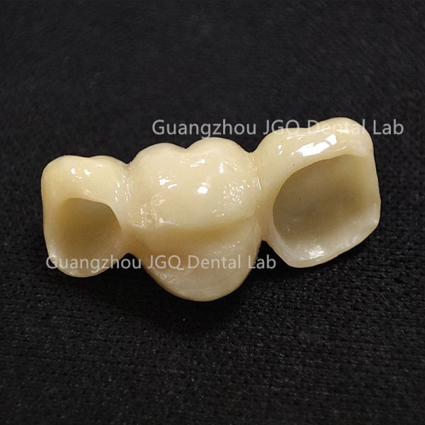 Monolithic Zirconia Crowns Dentures CAD/CAM 1200 MPa Flexural Strength for Dental Bridges