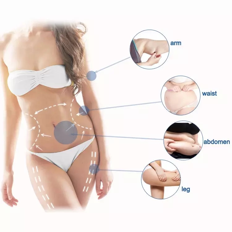 Liposonix для тела уменьшая машину/высокую интенсивность сфокусировало машину ультразвука