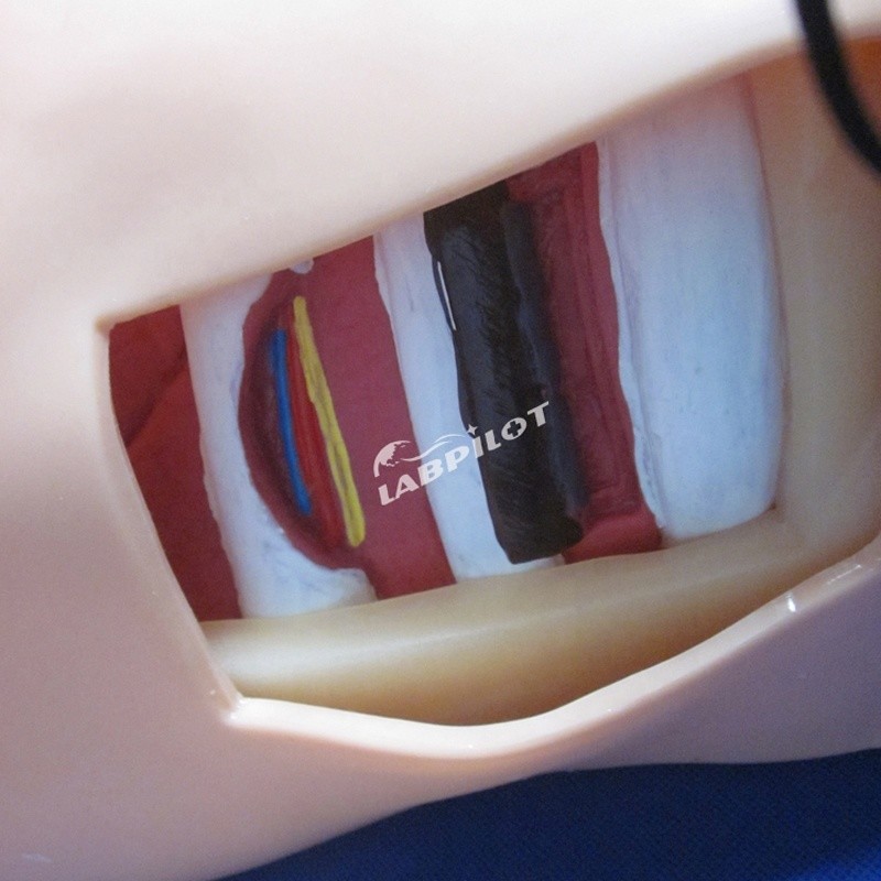 Advanced PVC Manikin for Nursing Training of Pleural Puncture Drainage and Thoracentesis