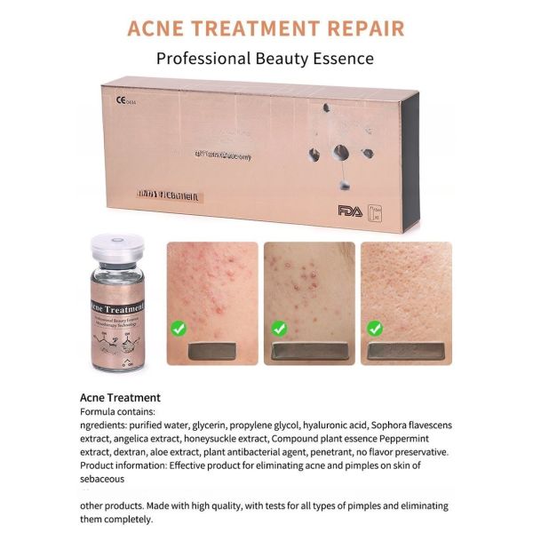 Customized Label Stalidearm Organic Herbal Serum Anti Acne Dermal Face Essence for Skin Renewal