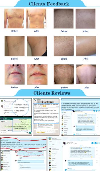 Germany imported filter smart beauty instrument 808 diode laser hair removal machine