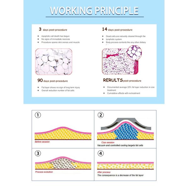 LF-251 Portable Mini Cryo Frozen Fat Machine Mini Cryotherapy Pad Frozen Freeze Slimming Cool Fat Machine