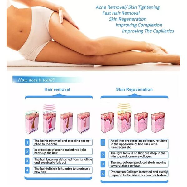 600nm к удалению 2000W волос дома Shr машины удаления волос 950nm IPL портативному