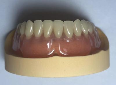 Dental Lab Acrylic Full Arch Dentures Easy To Use With Natural Shape