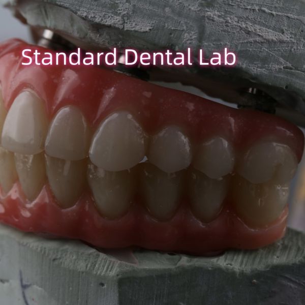 Dental Implant Crown PFZ Porcelain Layered Zirconia Screw Retained With Pink Gum