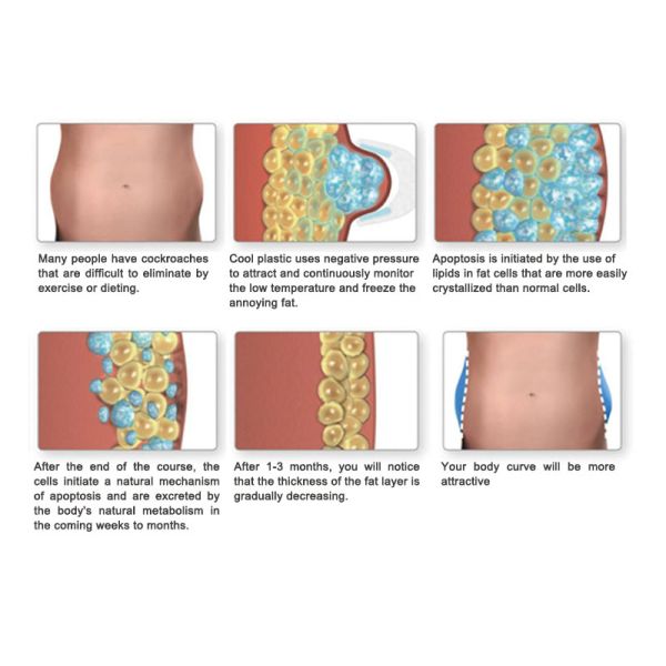 Professional Cryolipolysis Fat Freeze Slimming Machine Safe And Effective