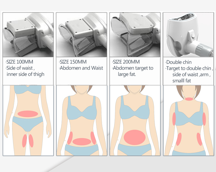 Машина Cryolipolysis компактного размера жирная замерзая отсутствие хирургического взреза