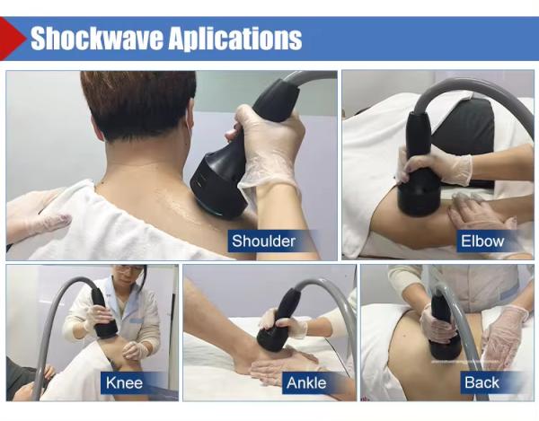 Shock Wave Therapy Ed Shockwave Erectile Dysfunction Focus Shock Wave Pain Relief Eswt Shockwave Therapy Machine