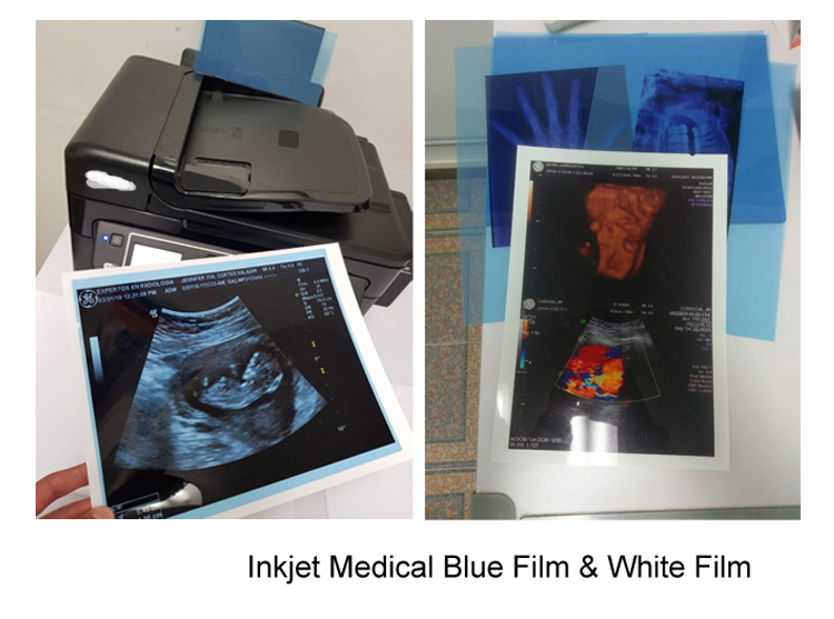IMATEC Blue PET Inkjet Medical CR рентгеновская рентгенографическая пленка для принтеров Canon