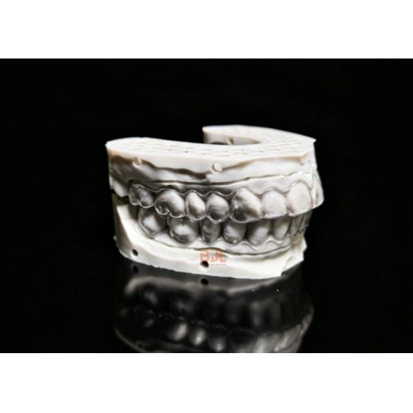 Removable Comfortable Dental Retention Appliance Designed for Easy Cleaning and Consistent Orthodontic Retention Results
