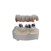 3D dentaire a imprimé la zircone couronne haut Biocompatibility résistant à l'usure
