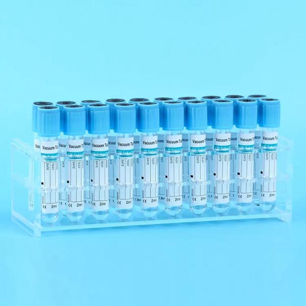 Le citrate de sodium est utilisé pour les tests de coagulation de l'échantillon sanguin, le temps de coagulation, le temps de prothrombine.