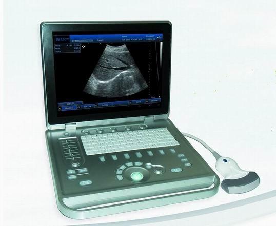 3D Digital Laptop Portable Ultrasound Scanner With All Kinds of Probe