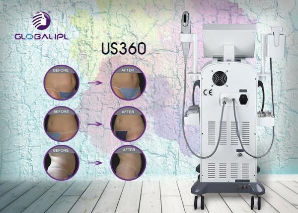 Non Surgical Body Liposonix Fat Reduction Hifu Machine For Body Slimming
