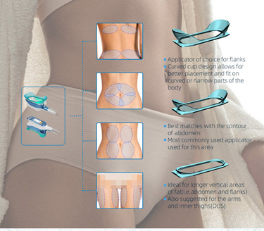 perda gorda da máquina fresca multifuncional do emagrecimento 1500W