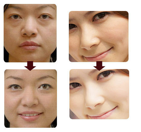 Permanent 808nm Diode Laser Hair Removal Machine with 1 - 10 HZ Frequency