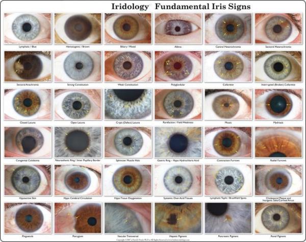 12 MP Iridology Iriscope Iridology Camera