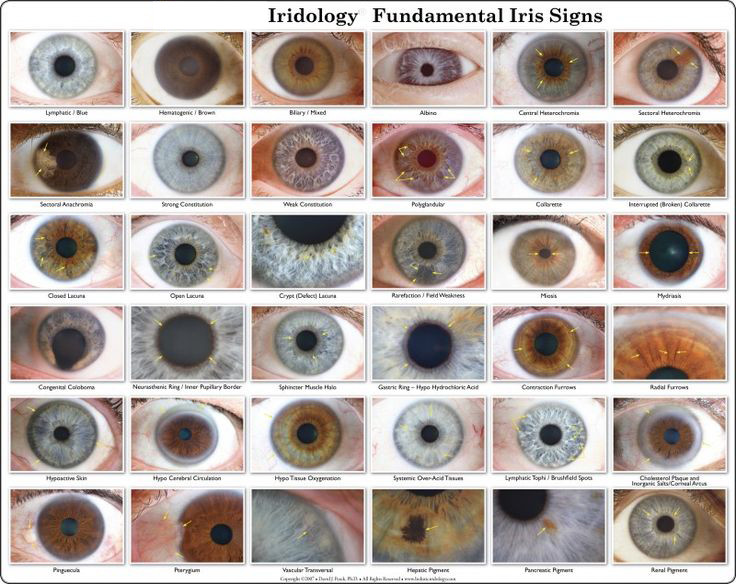 12 анализатор здоровья тела Iriscope глаза USB цифров Iridology разрешения MP высокий