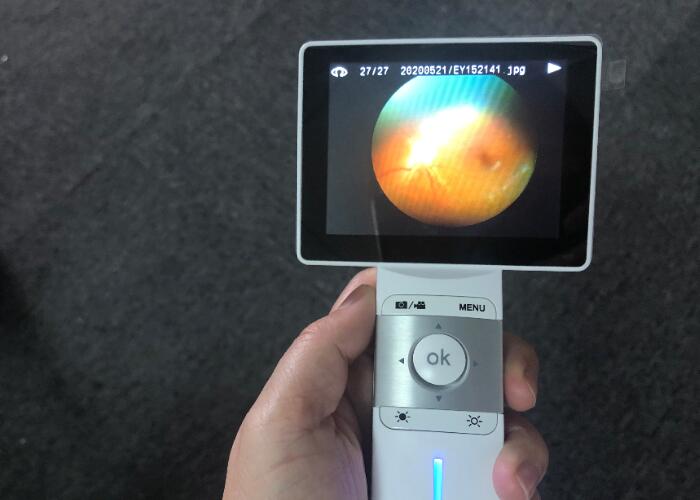 Телемедицина FOV 45° Wifi камеры цифров Handheld Fudus облегченного портативного офтальмоскопа опционная